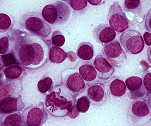Fine-needle aspirate of a histiocytoma containing cells with a round to oval nucleus and moderately abundant blue cytoplasm that lacks vacuoles and granules. 