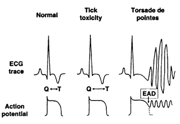 Long QT syndrome- Campbell and Atwell, 2002